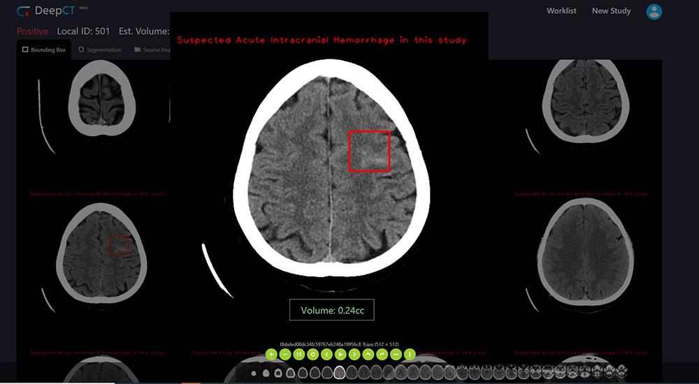 DeepCT volume