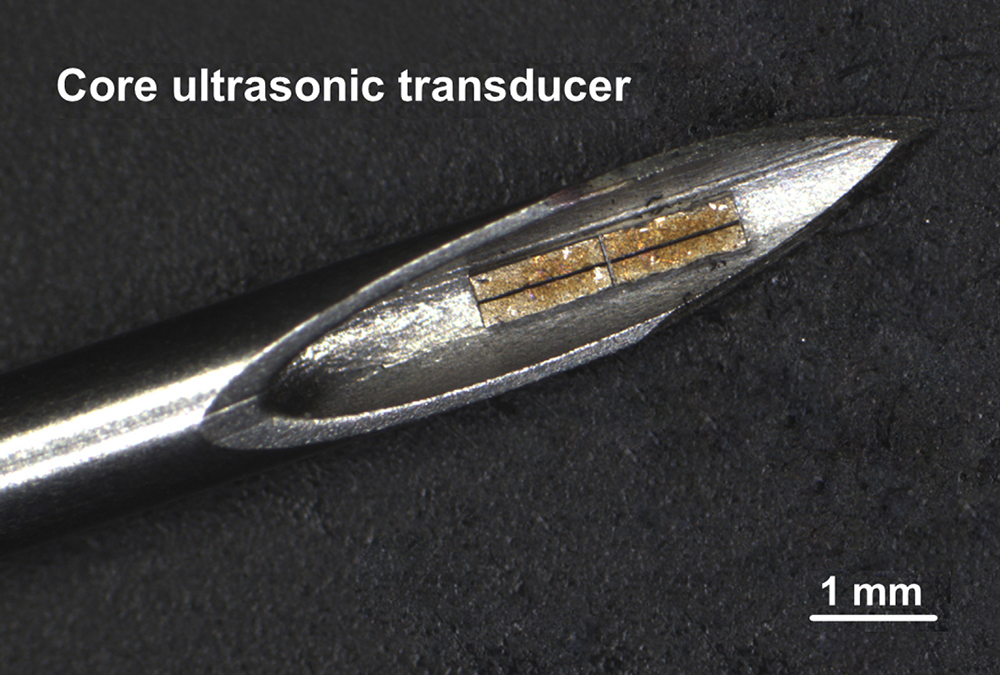 SoundJet Medical_core ultrasonic transducer