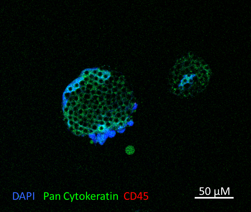 immnolfluorescence staining of CTC-derived organoid